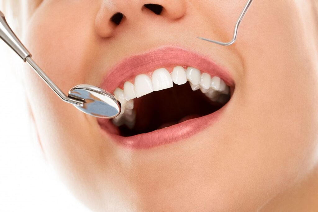 Best Foods for Strong Teeth and Healthy Gums