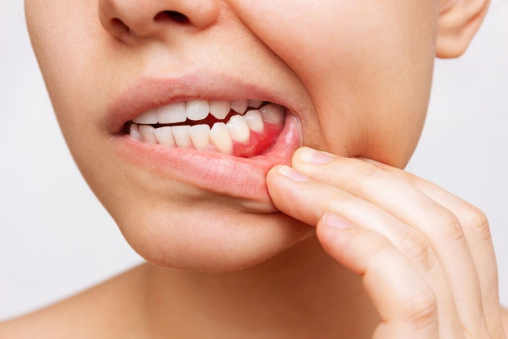 The Silent Threat: Why Oral Cancer Screenings Are Essential—Even If You Feel Fine