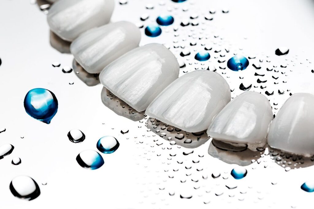 Porcelain Veneers: A Natural Looking Upgrade for Chips, Gaps, and Stains